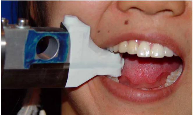 Figura 4.8. Mensuração da força de mordida sendo realizada na região de  primeiro molar direito