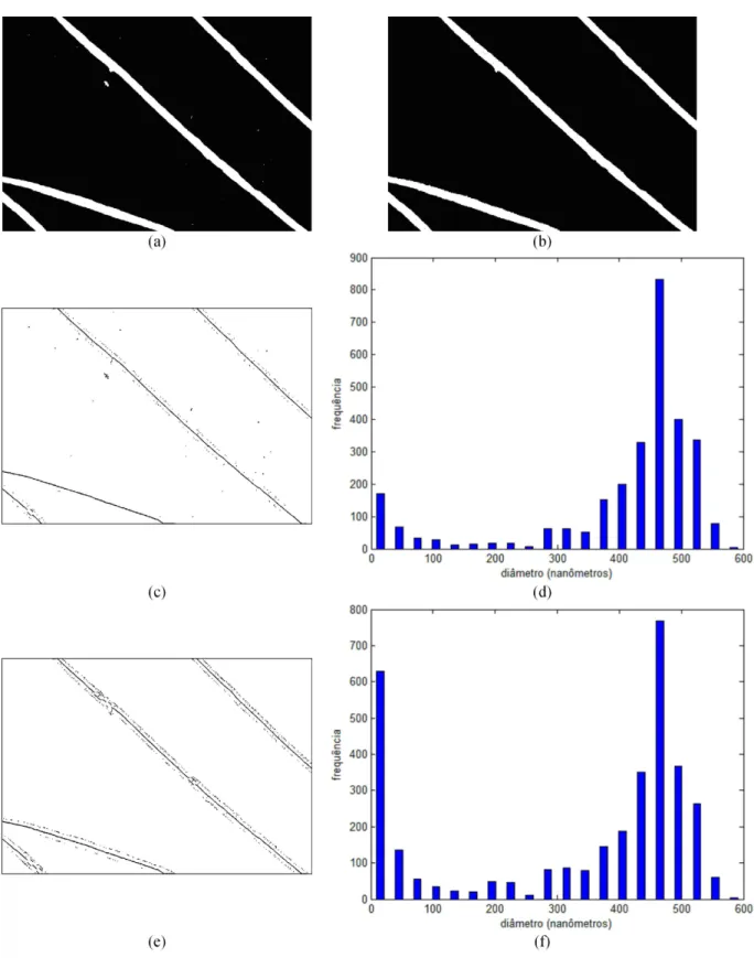 Figura 5.8: Imagens processadas pelos algoritmos de segmenta¸c˜ao: (a) CNN e (b) Morfologia, suas respectivas imagens de esqueleto em (c) e (e) e seus respectivos