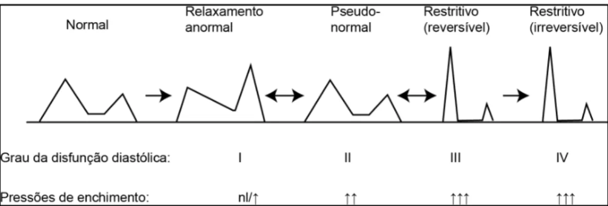 Figura 1 - Fluxo transmitral ao Doppler pulsátil