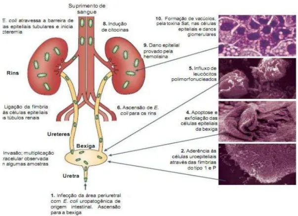 Figura  1.  Patogenia  da  infecção  do  trato  urinário  (ITU)  causada  por  Escherichia  coli  uropatogênica  (UPEC)