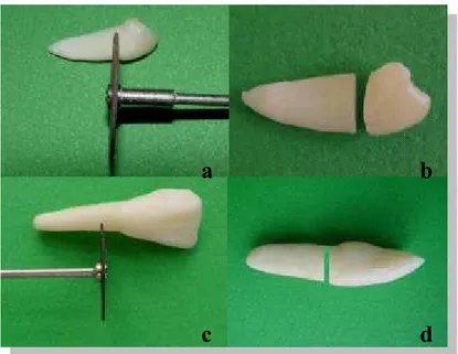 Figura 1 – a) secção da coroa (dente humano); 