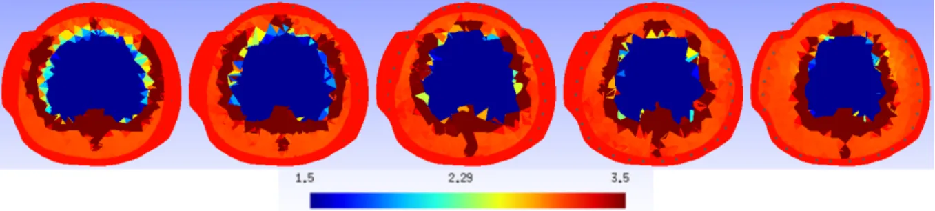 Figura 4.26: Imagem reconstruída para PEEP de 5 cmH 2 O, para 1, 5 &lt; ρ &lt; 3, 5 Ω .m