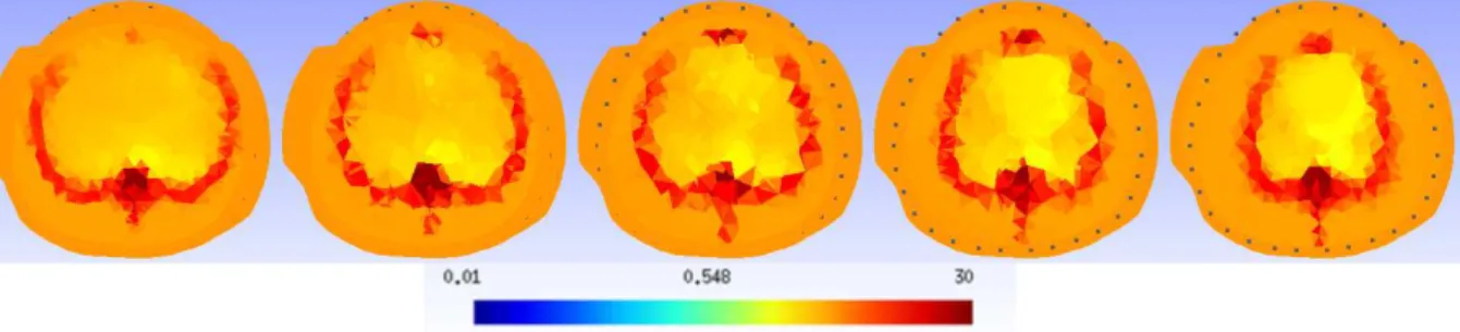 Figura 4.29: Imagem reconstruída para PEEP de 5 cmH 2 O. Valores corrigidos, com duas correntes.