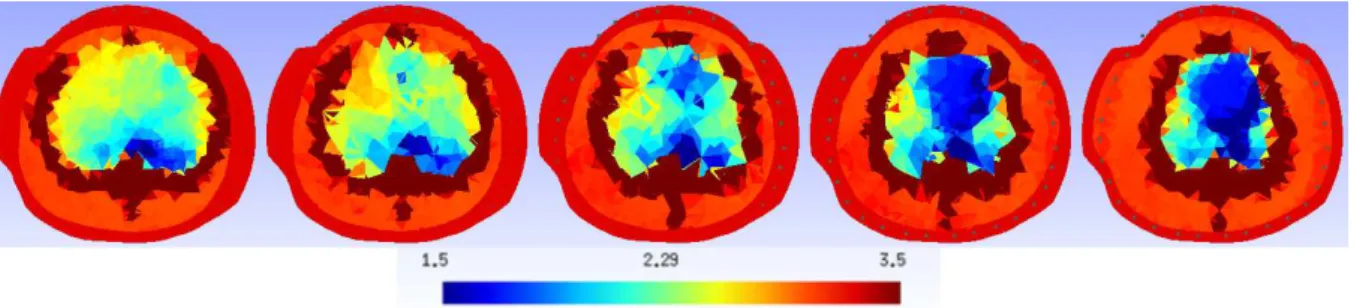 Figura 4.31: Imagem do termo (ρ − ρ ¯ ) para PEEP de 5 cmH 2 O, para λ 2 = 10, γ 2 = 10 − 11 e β = 10 − 12 