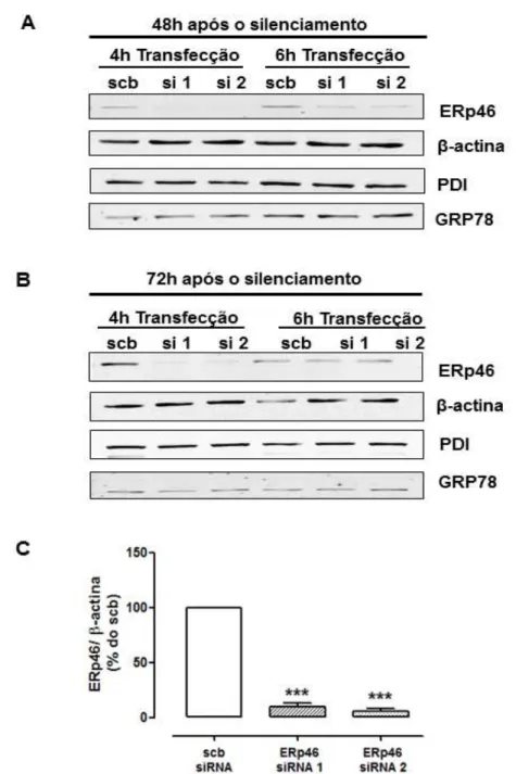 Figura 7 –  Silenciamento da ERp46 através de transfecção com siRNA em  células endoteliais 