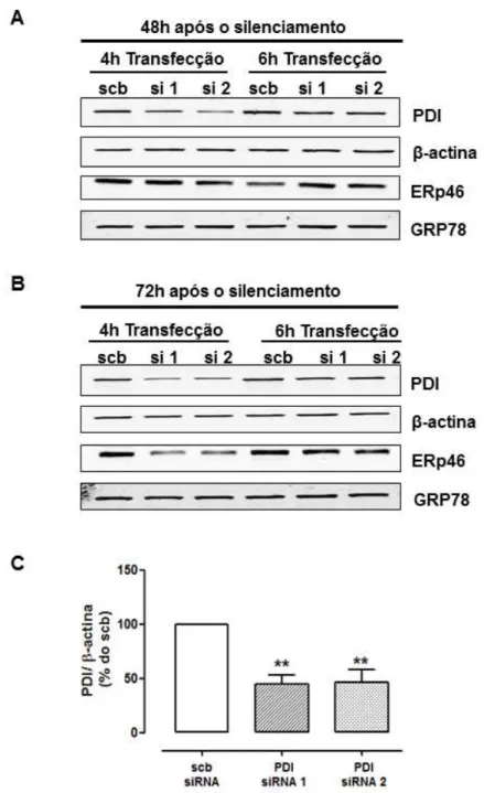 Figura 8 – Silenciamento da PDI através de transfecção com siRNA em células  endoteliais