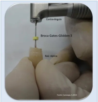 Figura 5.8 -   Demonstração da desobturação da raiz (réplica) em resina utilizando broca de Gates-Glidden n°3 acoplado em contra ângulo e  micromotor Dabi-Atlante® 