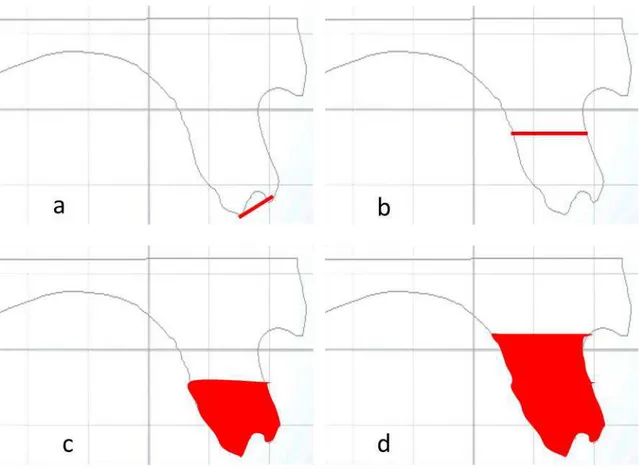 Figura  2:  Imagem  esquemática  representando  as  medidas  realizadas  no  software  3Shape  OrthoAnalyzer™ , após escaneamento dos modelos de gesso