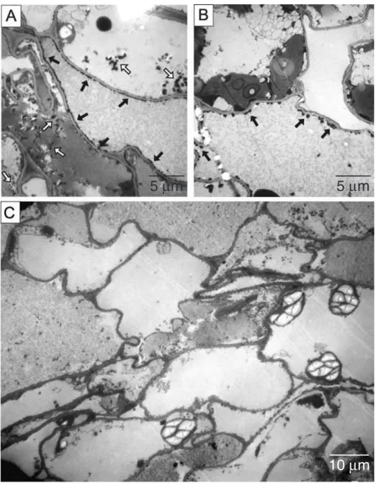 Fig. 3. Cytochemical detection of urease in leaf cells of Vriesea gigantea plants by transmission electron microscopy