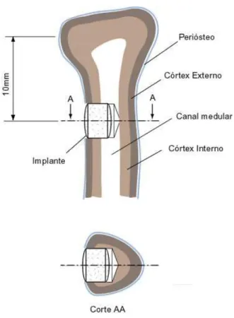 Figura 3.5 – Desenho da inserção do implante ao osso. O defeito foi realizado em uma  cortical óssea 