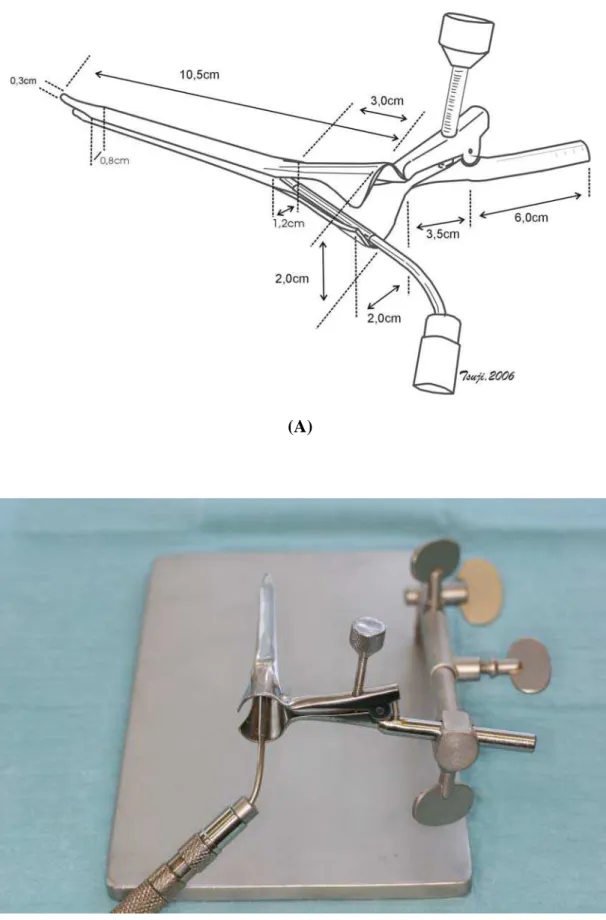 Figura 1 – Laringoscópio: (A) esquema; (B) foto 