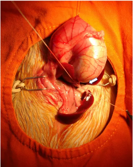 Figura  3.  Vasos  gástricos  curtos  sendo  ligados  (seta)  e  posteriormente  seccionados  para  isolamento completo da cauda do pâncreas