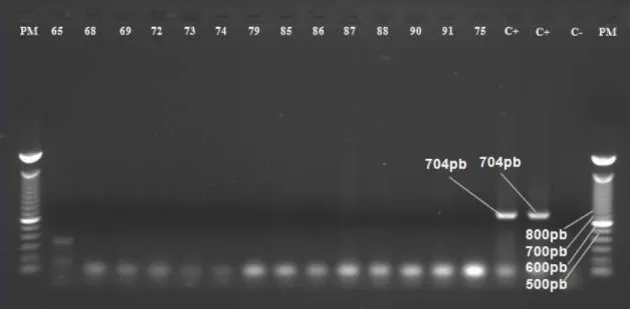 Figura  10  –  Eletroforese  em  gel  de  agarose  dos  produtos  amplificados  na  PCR  utilizando  “primers”  IMM-7  MP  e  IMM-5  MP  com  DNA  das  amostras  coletadas e da cepa de referência de M