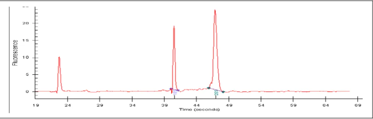 Figura 8. Eletroferograma (do  Agilent Bioanalyzer 2100) representando uma amostra  com  alta  qualidade  de  RNA  total