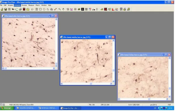 Figura 1. Representação do software Image-Pro®Plus, evidenciando capturas de imagens em  campo  claro  de  cortes  coronais  (40 m)  do  encéfalo  de  rato  Wistar,  com  elementos  gliais  marcados  na  região  do  hipocampo