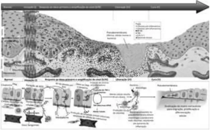 Figura 2.1 - Biopatologia da mucosite oral dividida em cinco fases: iniciação, resposta ao dano  primário (sinalização), amplificação do sinal, ulceração e cura (Sonis, 2011)