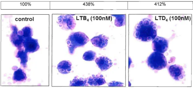 Figura 15: Ilustração do aumento da fagocitose de C.alblcans em macr6fagos alveolares estimulados com leucotrlenos