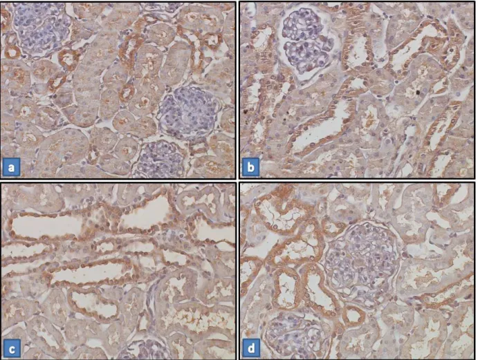 Figura 9 – Imunolocalização de Angiotensina II no córtex renal de um rato controle – C (a), de um rato deficiente em  vitamina D – dVD (b), de um rato que recebeu TDF – TDF (c) e de um rato deficiente em vitamina D que recebeu TDF  – dVD+TDF (d)