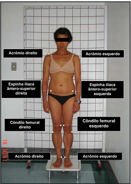 Figura 8 - Vista anterior e pontos anatômicos 