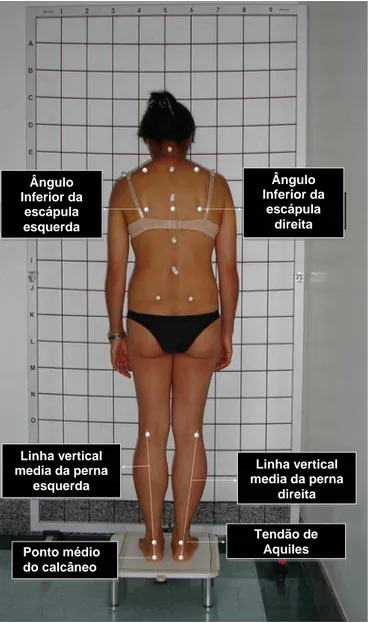 Figura 10 - Pontos anatômicos em vista posterior 