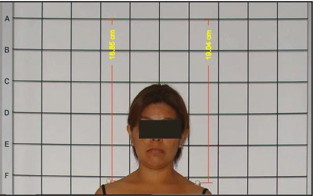 Figura 13 - Avaliação quantitativa da altura do ombro no plano frontal 