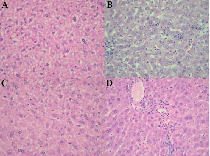 Figura  7.  Cortes  histológicos  do  fígado  de  camundongos  após  16  dias  de  infecção