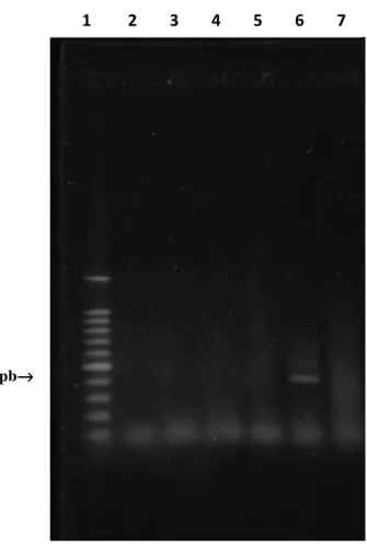 Figura 6 -  Fotografia de gel de agarose corado com SYBR ®  Gold, sob luz UV, ilustrando resultado de  amplificação  de  fragmentos  de  432bp,  relativo  ao  gene  pol  do  genoma  de  BoAstV,  após  aplicação  das  técnicas  de  RT-PCR,  a  partir  de  a