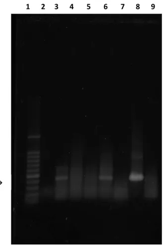 Figura 7 -  Fotografia de gel de agarose corado com SYBR® Gold, sob luz UV, ilustrando resultados  de amplificação de fragmentos de 432bp, relativo ao gene pol de astrovírus bovino, obtidos  através das técnicas de RT-PCR a partir de amostras fecais bovina