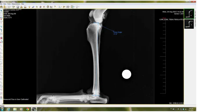 Figura 4  – Imagem  obtida  do  programa  computacional  Orthoplan  utilizado  para  mensuração  do  ângulo do platô tibial das peças, as linhas de cor azul representam os eixos que unem  o centro da articulação talocrural com a eminência intercondílea e o