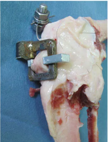 Figura 8 -  Transdutor de tensão tipo fivela de aço com moldura quadrada de 25 mm de largura e  5  mm  de  espessura;  com  trava  central  removível  de  5  mm  de  largura,  inserido  no  ligamento patelar  –  São Paulo 2013  –