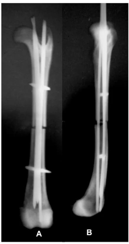 Figura 4.7 – Imagens fotográficas dos estudos radiológicos dos corpos de prova com   a técnica do PIMB, (A) - vista crânio – caudal, (B) - vista latero - lateral 