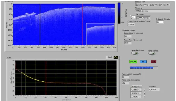 FIGURA 12: Interface do programa utilizado para análise das imagens. 