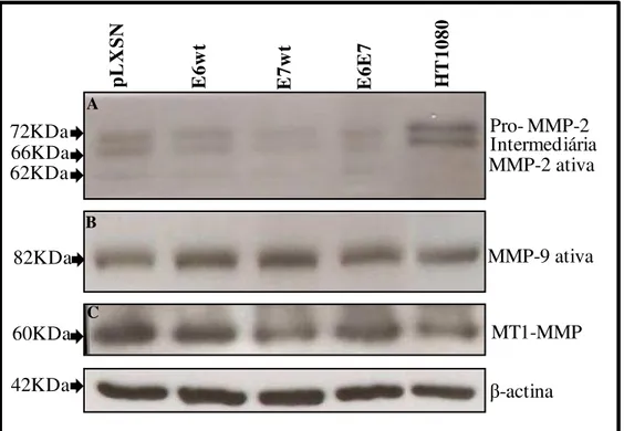 Figura  7: Determinação  dos  níveis  protéicos  de  MMP-2,  MMP-9  e  MT1-MMP  por  western blot em amostras de QPHs infectados