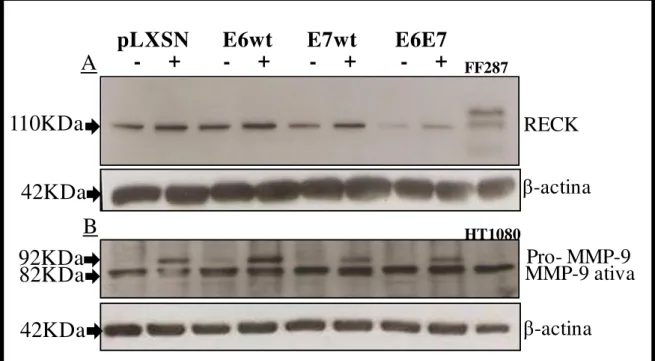 Figura  8: Determinação  dos  níveis  protéicos  de  RECK  e  MMP-9  por  western  blot  em  amostras  de  culturas  em  monocamada  sem  e  com  tratamento  com  TNF
