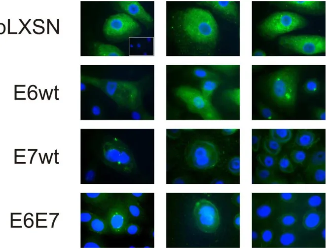 Figura 9: Detecção da proteína RECK através de ensaio de imunocitoquímica em QPHs  infectados com pLXSN, E6wt, E7wt e E6E7