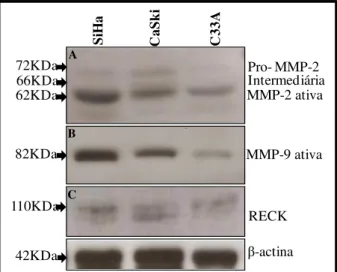 Figura 10:  Determinação dos níveis protéicos de MMP-2, MMP-9 e RECK por western blot em  amostras linhagens de carcinoma cervical humano