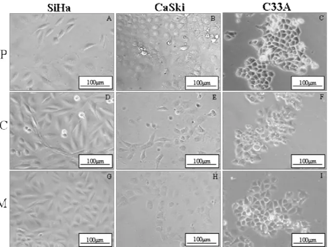 Figura 3: Aspectos morfológicos das células SiHa, CaSki e C33A cultivadas por 5 dias,  observadas em microscopia de contraste de fase, cultivadas em diferentes substratos