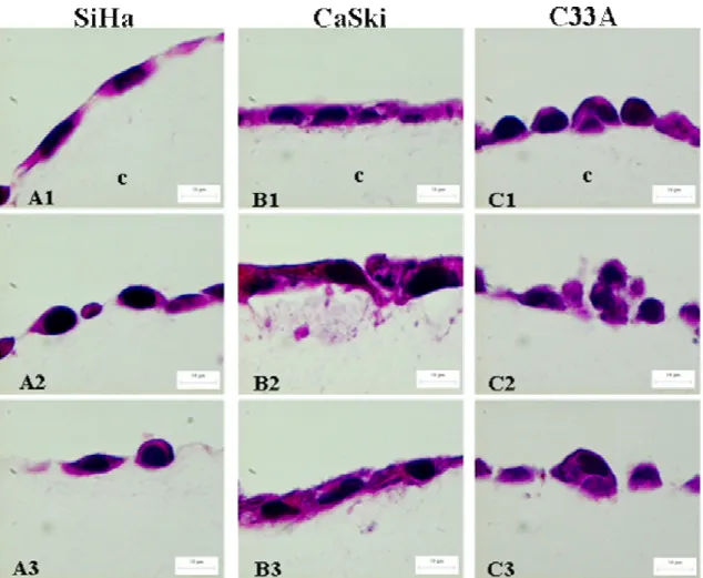 Figura 4: Ensaio de Invasão em colágeno: Microscopia óptica das células cultivadas em  colágeno tipo I por 5 dias coradas com HE