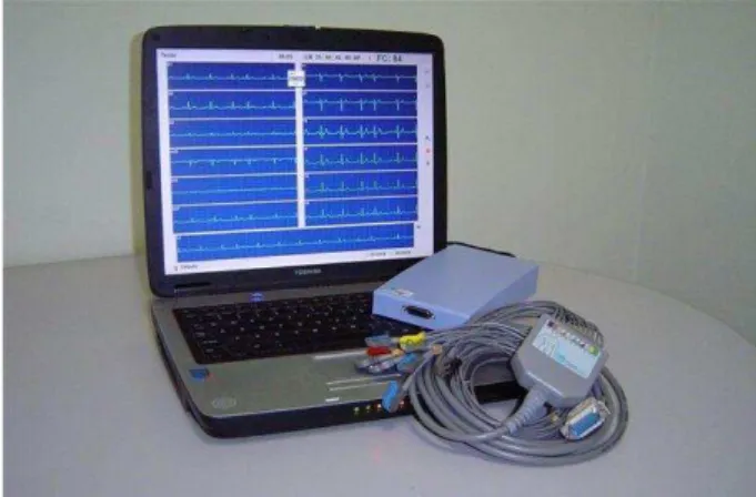 Figura  2  –   Equipamento  de  eletrocardiografia  de  repouso  e  esforço  utilizado  na  avaliação  dos  idosos