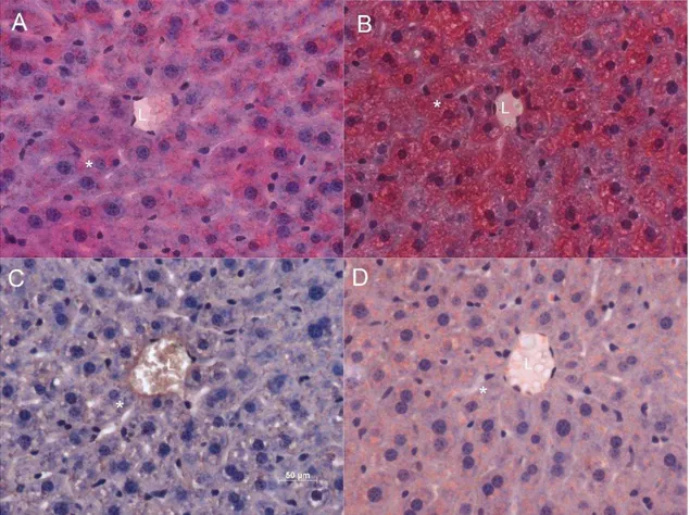 Figura  3:  Dieta  hiperlipídica  induz  aumento  de  microvesículas  de  lipídeos  em  hepatócitos de camundongos