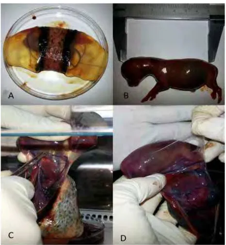 Figura 1: Coleta e separação da membrana amniótica. 