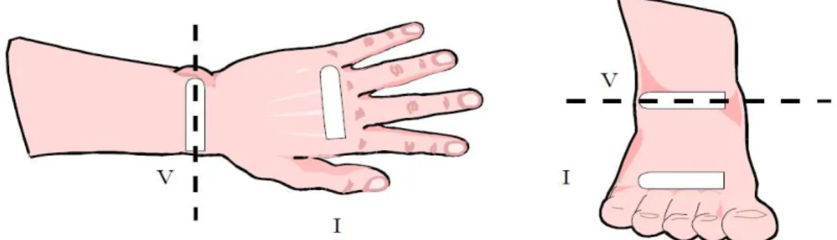 Figure 3: Example of how the electrodes must be placed in the right hand and foot  for BIS assessment