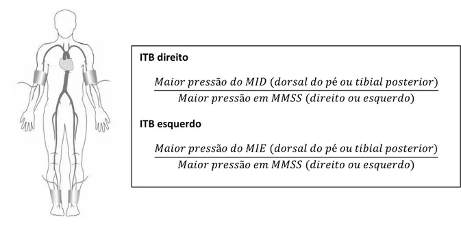 Figura 2: Medida do ITB com o uso do Doppler portátil. MID: membro inferior  direito; MIE: membro inferior esquerdo; MMSS: membros superiores