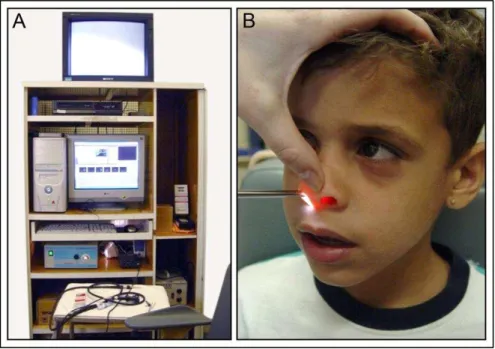 Figura 1 – Nasofibroscopia (A: aparelho e B: exame). 