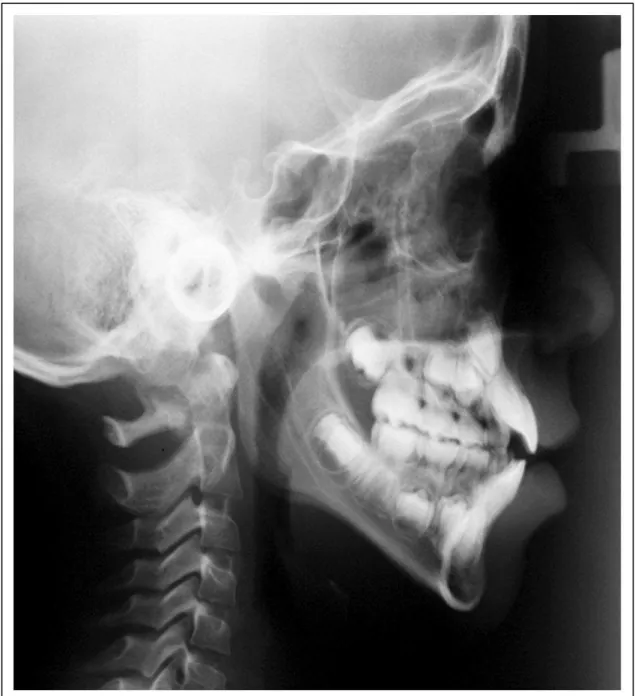 Figura 7 – Radiografia cefalométrica. 