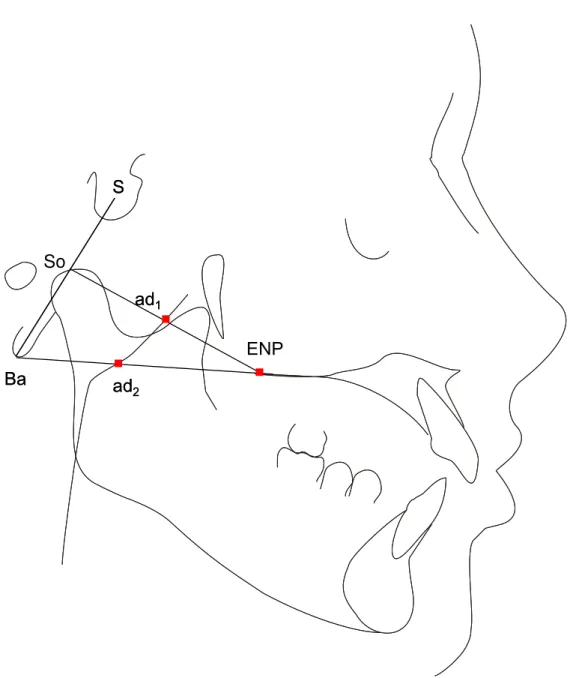 Figura 8 – Traçado cefalométrico em norma lateral, pontos cefalométricos e área da nasofaringe