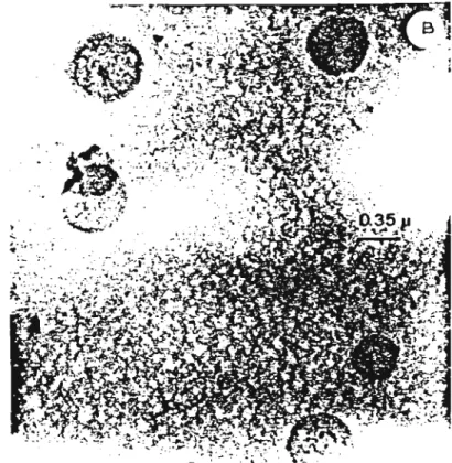 Fig. I. Electran micrographs or large DODAC liposomes positi\'e1y slained