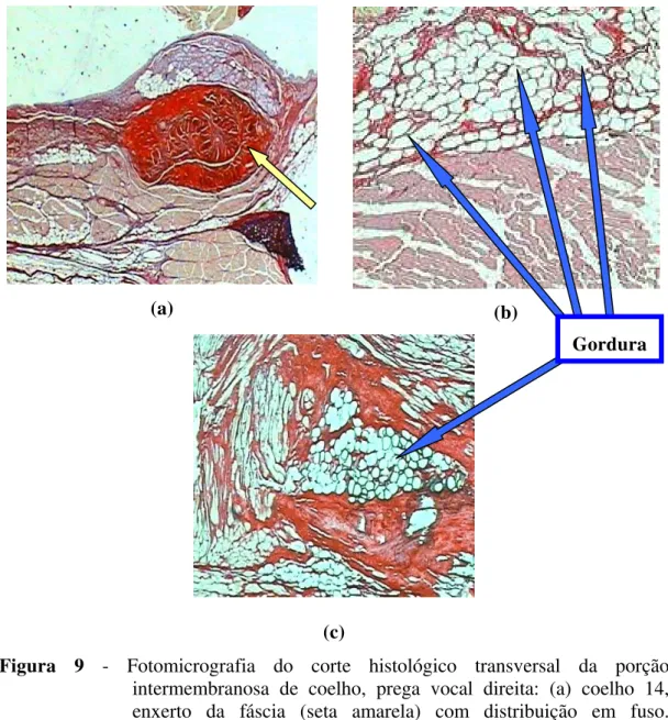 Figura 9 - Fotomicrografia do corte histológico transversal da porção  intermembranosa de coelho, prega vocal direita: (a) coelho 14,  enxerto da fáscia (seta amarela) com distribuição em fuso