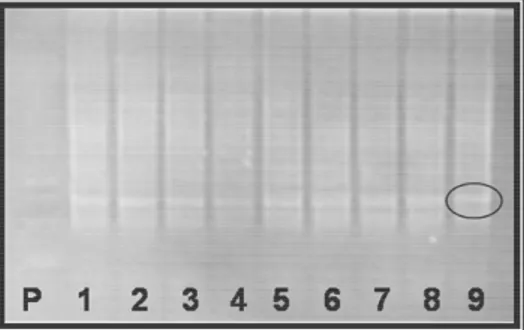 Figura 7 - Gel de eletroforese dos produtos da amplificação em larga escala dos dímeros de cDNA