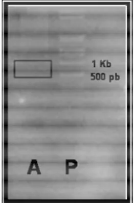 Figura 9 - Gel de eletroforese dos produtos da ligação das ditags. (A) Concatâmeros da amostra; (P)  Padrão de DNA